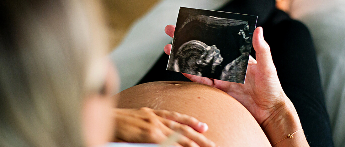 Your Guide to a Healthy Pregnancy (From Conception to Birth)