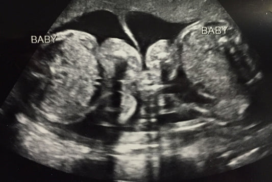 Two to Kiss, Two to Love: Identical or Fraternal