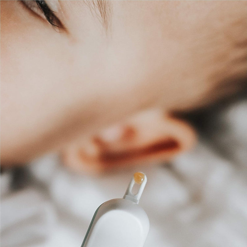 Parent uses Frida 3-in-1 Nose, Nail, and Ear Picker on baby's ear